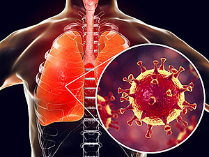 coronavirus-covid-194